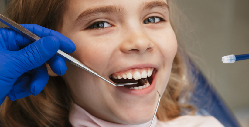 Dental Sealants to Protect Pits and Fissures on Molars