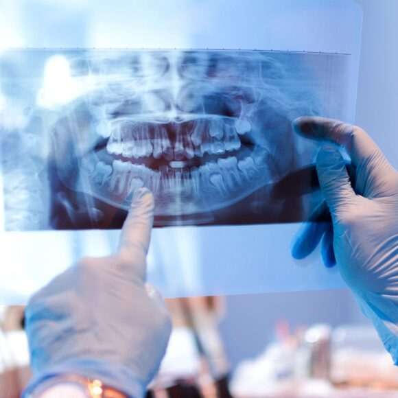 Dental Radiography – What Is It And What Is It Used For?