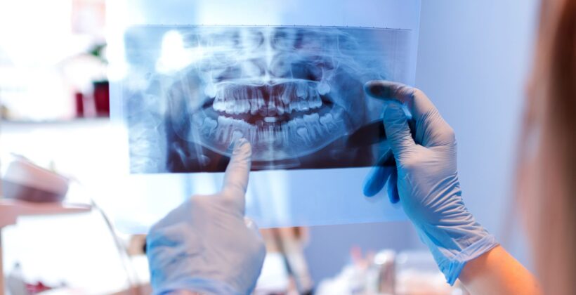 Dental radiography - x-ray review at Midland Bay Dental.