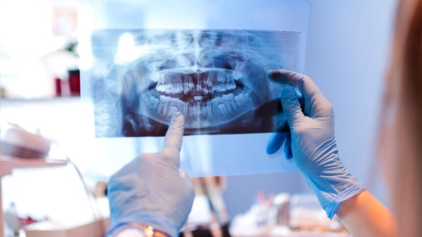 Dental Radiography – What Is It And What Is It Used For?