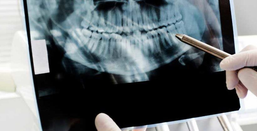 Dental Radiography – What Is It And What Is It Used For?