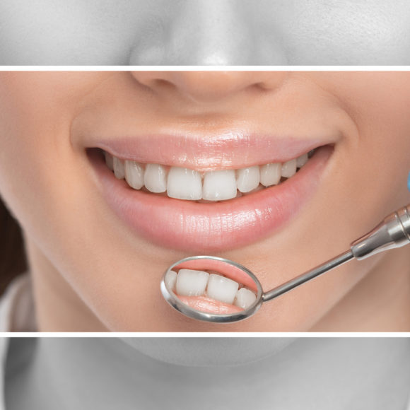 Dental Crowns and Bridges Procedure – What Can I Expect?