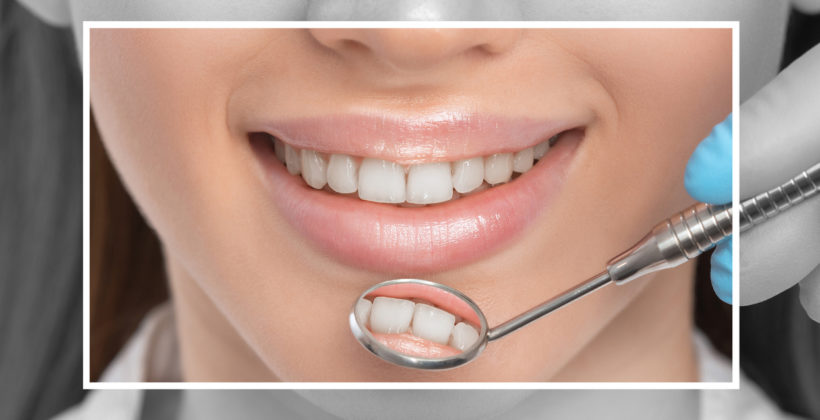 Dental Crowns and Bridges Procedure – What Can I Expect?