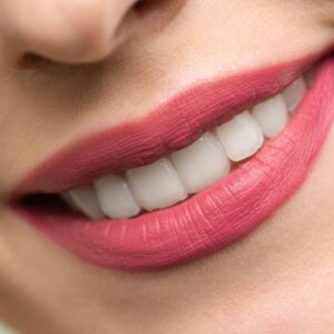 Discover Beautiful Smiles at Midland Bay Dental — Your Top Choice for Cosmetic Dentistry Near Me