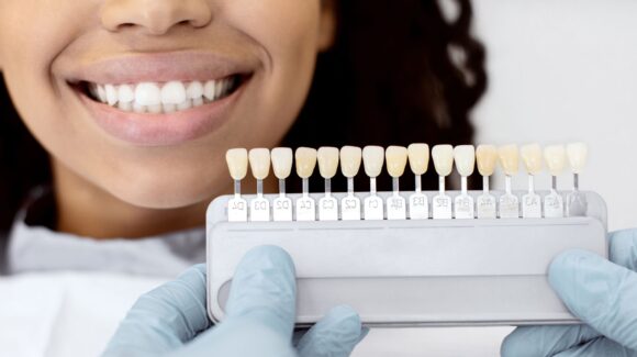 What is the Difference Between Crowns and Bridges: What You Need to Know