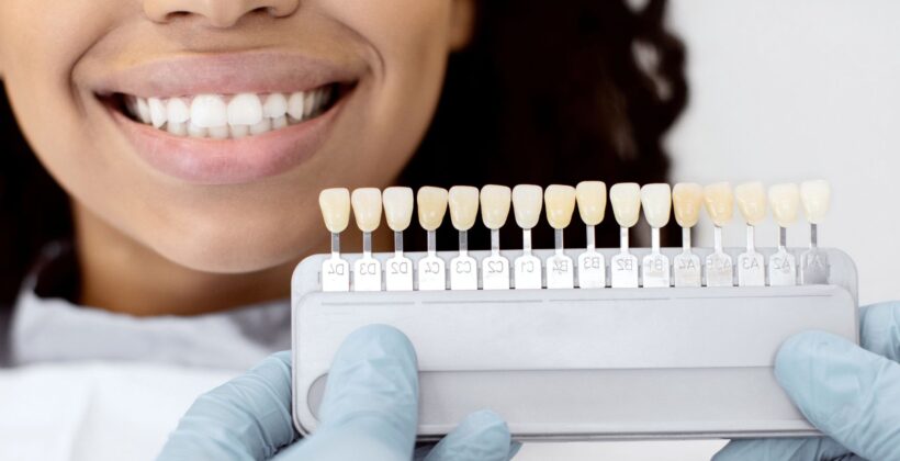 What is the Difference Between Crowns and Bridges: What You Need to Know