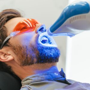 Is Professional Teeth Whitening Worth It? What You Need To Know Is Professional Teeth Whitening Worth It? What You Need To Know