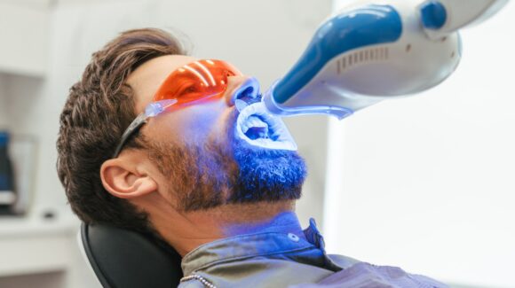 Is Professional Teeth Whitening Worth It? What You Need To Know