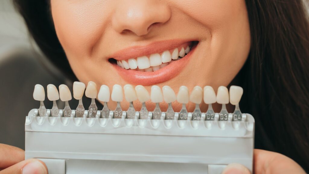 Faceless woman with sample teeth colours - professional teeth whitening with Midland Bay Dental.