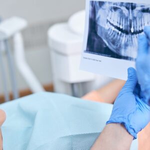 Wisdom Teeth Removal: When Do They Grow In and Do You Need Them Extracted?
