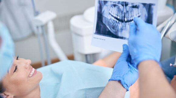 Wisdom Teeth Removal: When Do They Grow In and Do You Need Them Extracted?