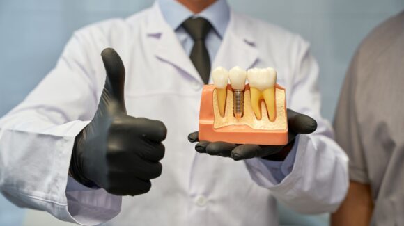 Dental Implants vs. Bridges vs. Dentures: Which Is Right for You? Dental Implants vs. Bridges vs. Dentures: Which Is Right for You?