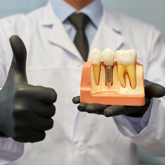 Dental Implants vs. Bridges vs. Dentures: Which Is Right for You?