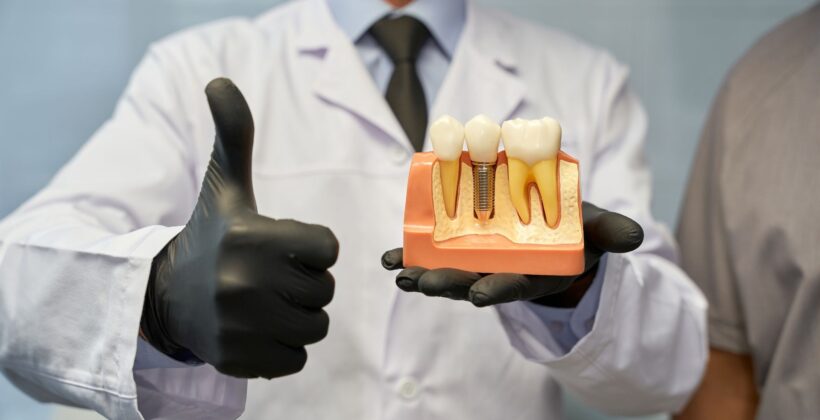 Dental Implants vs Bridges vs Dentures - dentist holding dentures - Midland Bay Dental.